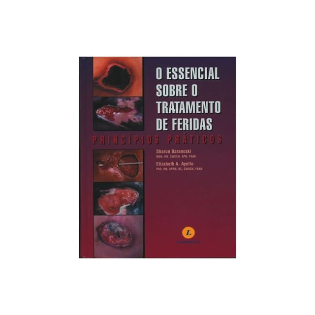 Essencial sobre o Tratamento de Feridas, o - Principios Praticos