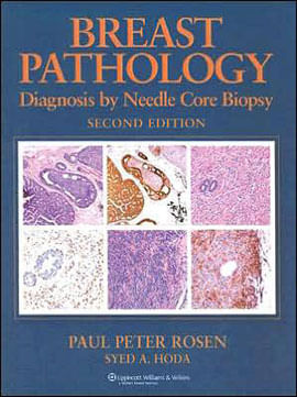 Breast PáThology - Diagnosis By Needle Core Biopasy