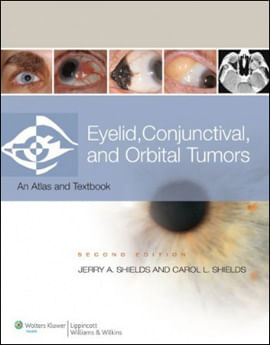 Eyelid, Conjunctival, And Orbital Tumors And Intraocular Tumors - An Atlas And Text (2 Vol. Set)