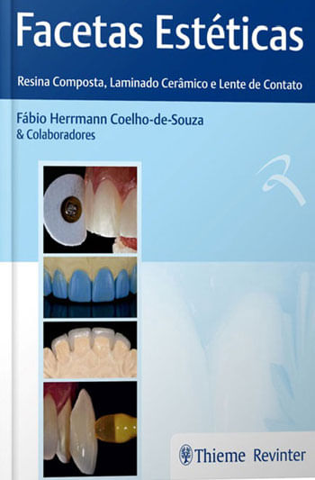 Facetas EstéTicas – Resina Composta, Laminado CerâMico e Lente de Contato