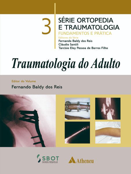 Traumatologia do Adulto - Vol. 3