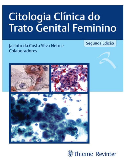 Citologia ClíNica do Trato Genital Feminino