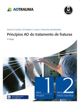 PrincíPios ao do Tratamento de Fraturas - 2 Volumes