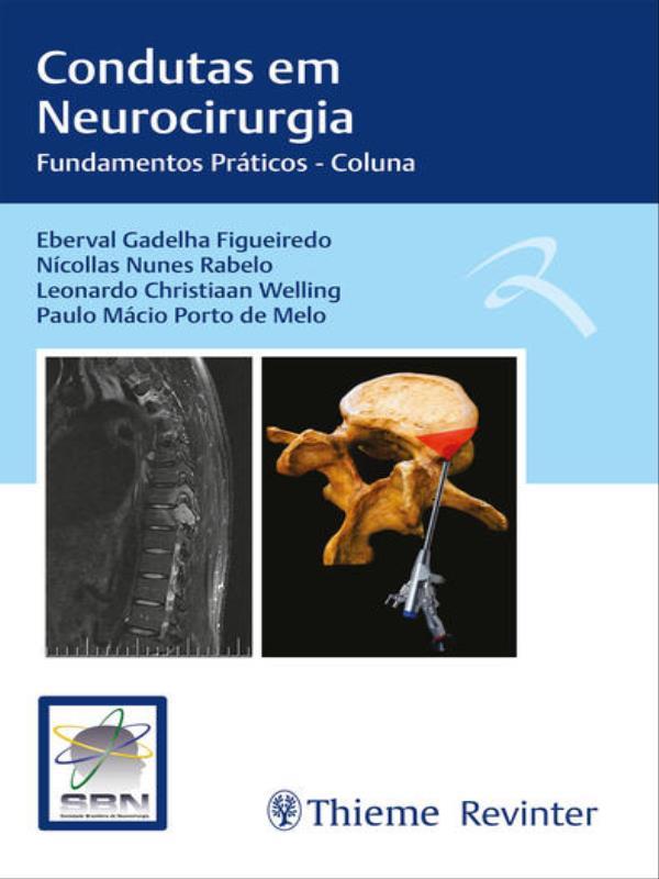 Sbn Condutas em Neurocirurgia