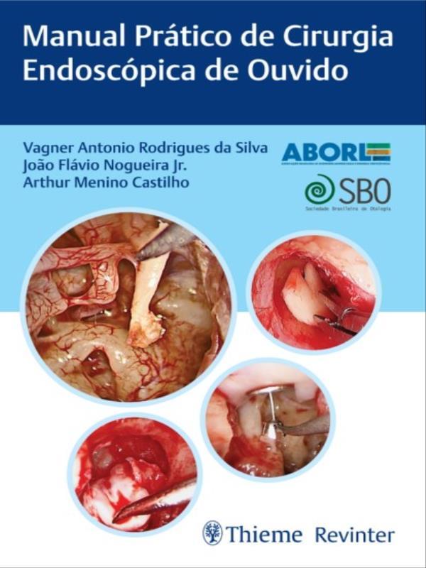 Aborl Manual PráTico de Cirurgia EndoscóPica de Ouvido