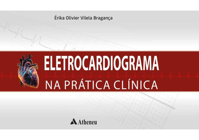 Eletrocardiograma na PráTica ClíNica